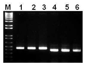 PCR and cloning of pK7GWIWG2(Ⅱ)binary vector.