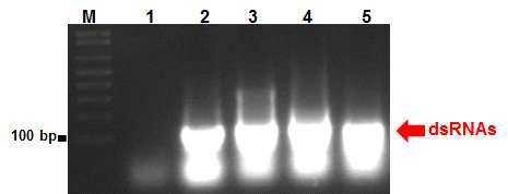 Electrophoresis patterns of dsRNA from bacterially expressed dsRNAi vector.