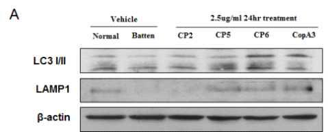 오토파지 경로에 관여하는 LC3 I/II 와 LAMP1 단백질 발현 관찰을 통한 오토파지 핵심경로 및 약물의 기능 차이 규명.