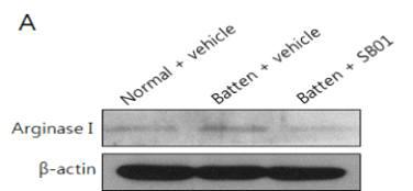 요소회로의 주요 효소인 arginase I 발현양상을 통한 SB01의 아미노산 대사의 기능 개선 규명.
