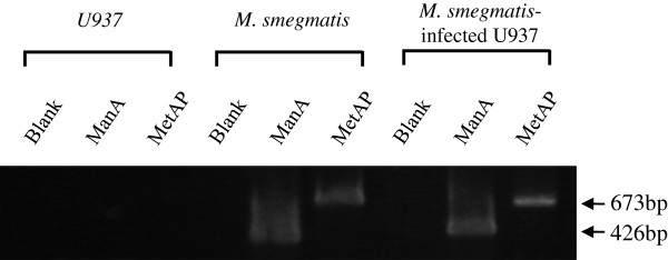 감염성 질환인 결핵균과 유사 미생물로 알려진 mycobacterium smegmatis의 human macrophagy cell 인 U937 세포의 감염여부 확인