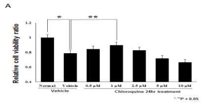 Chloroquine의 세포 생존율 변화 양상 측정.