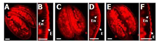 EtBr 염색 후 수술의 endothecium 층의 발달 확인. (A) SAF1 과발 현 식물체의 anther. (B) SAF1 과발현 식물체 anther의 확대 이미지. (C) 야 생형 식물체의 anther. (D) 야생형 식물체 anther의 확대 이미지. (E) SAF1-KD 식물체의 anther. (F) SAF1-KD 식물체 anther의 확대 이미지.