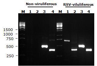 RT-PCR analysis of RSV viruliferous/non-viruliferous L. striatellus with specific primer sets. Lane: M, 1 kb DNA ladder; 1, RSV coat protein specific primer set; 2, RSV noncapsid protein specific primer set; 3, L. striatellus Cytochrome C oxidase subunit II specific primer set; 4, L. striatellus ATP synthase F0 subunit 6 specific primer set.