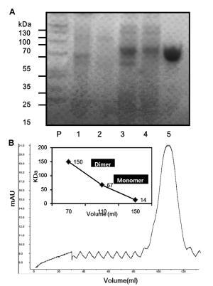 SoAsn의 과발현 확인 (A) (SDS-PAGE) 및 (B) oligemeric state