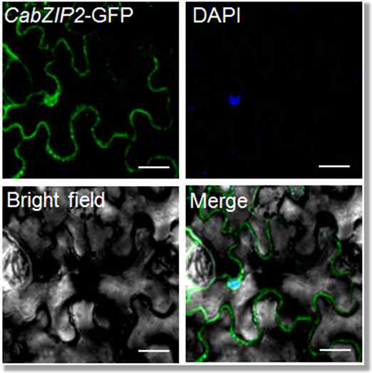 Localization of CabZIP2 protein.