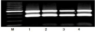 XSTS3B-49 분자마커의 DNA 패턴