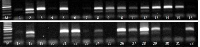 XSTS3B-52 분자마커의 DNA 패턴