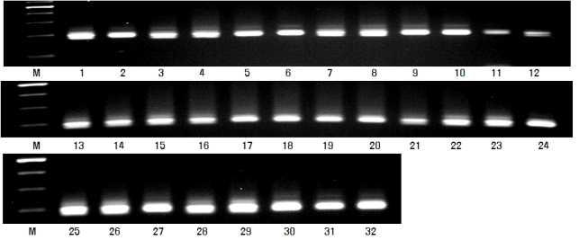 XSTS3B-66 분자마커의 DNA 패턴
