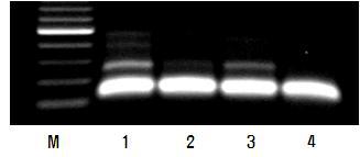 Xbarc133 분자마커의 DNA 패턴