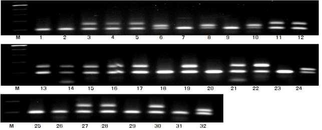 Xgwm533 분자마커의 DNA 패턴