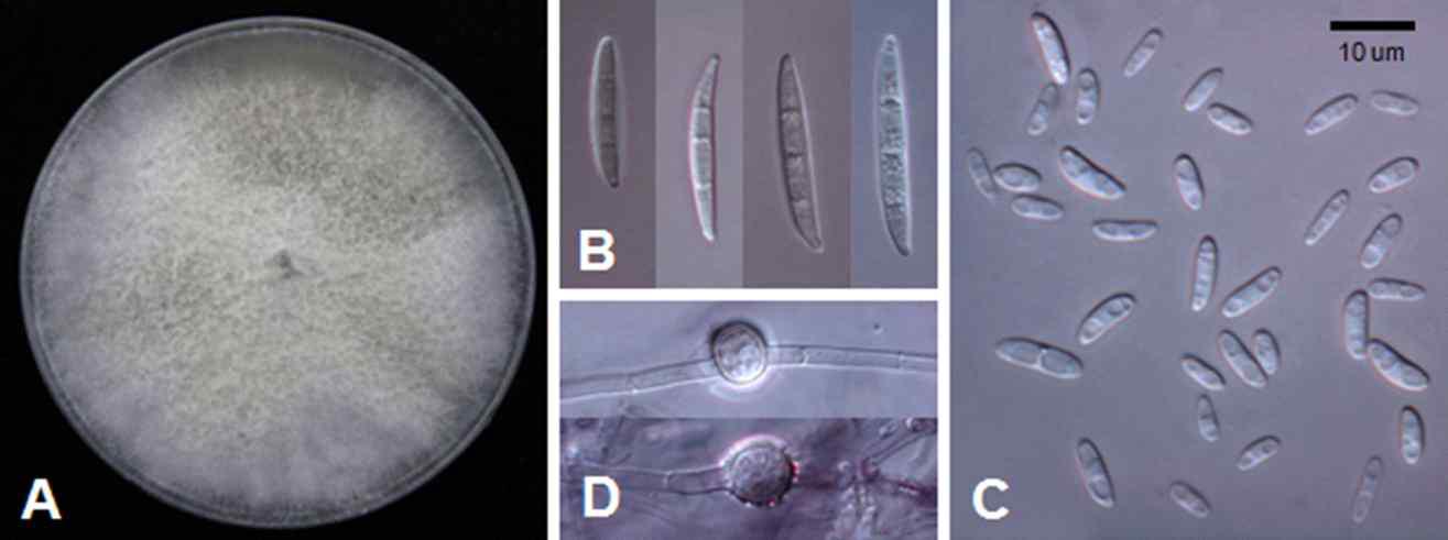 하수오에서 분리한 Fusarium oxysporum 균에 배양 및 형태적 특징