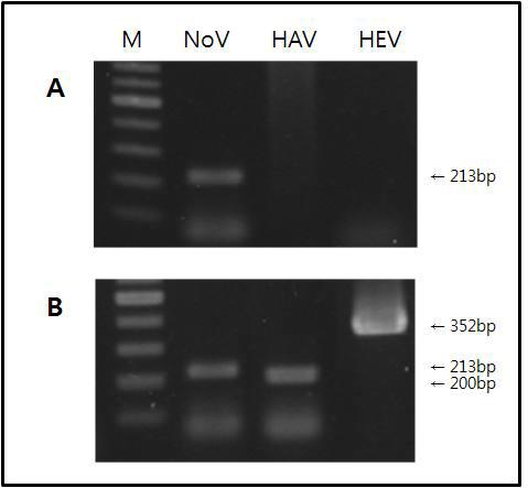 Enhanced reverse transcription-polymerase chain reaction (RT-PCR) assay for detecting norovirus (NoV) from enteric viruses using immunomagnetic separation