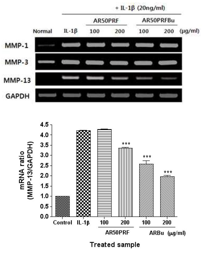 mRNA expression of MMPs in AR50PRF or ARBu and IL-1β treated SW1353 chondroma cell