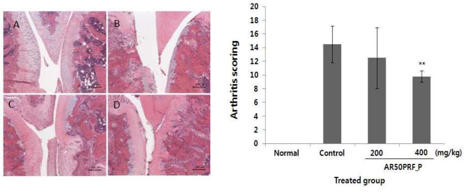 Histopathological lesions and arthritis scoring of knee cartilages separated from MIA-induced OA rats