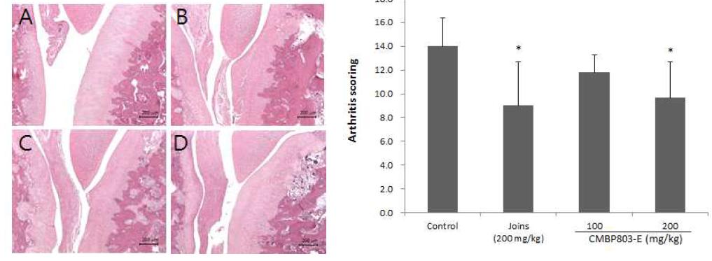 Histological pathogenesis of articμlar cartilage the femoral-tibial knee joint from rats with monosodium iodoacetate (MIA)-induced osteoarthritis.