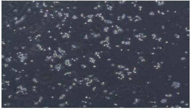 배양중인 PC-12 세포의 현미경 모습(X40)