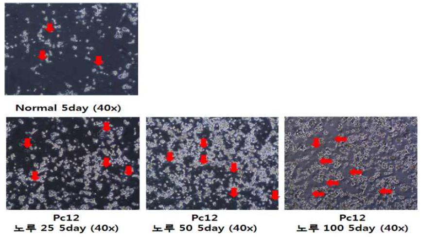 PC12 세포분화 및 70% 주정 노루궁뎅이버섯 추출물에 따른 neurite 생성변화