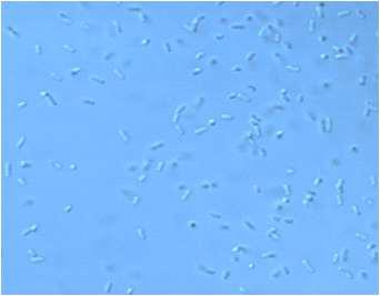 악취감소 세균 Bacillus subtilis 균주의 세포 형태