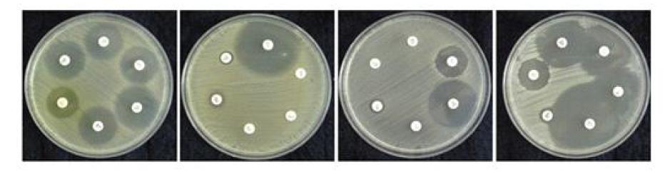 Staphylococcus aureus균들의 항생제 내성 실험