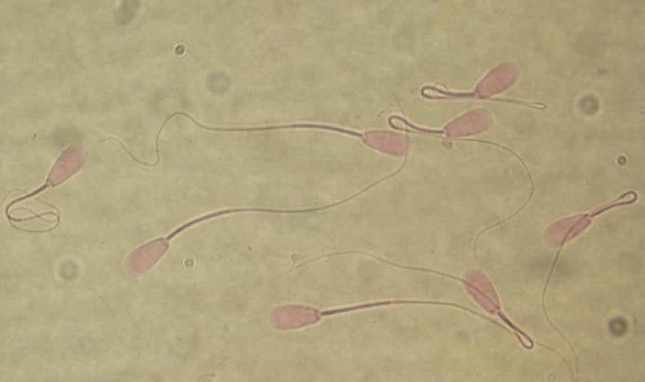 Abnormal morphology of sperm tails of white hanwoo