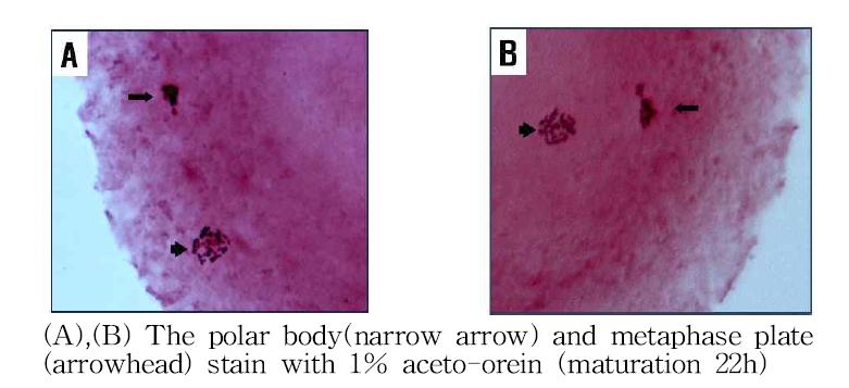 Aceto-orcein 염색법을 이용하여 Metaphase Ⅱ 단계 난자 체외성숙도 검토