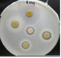 Bacillus circulans, Bacillus lichenifomis, Bacillus subtilis에서 동결건조 된