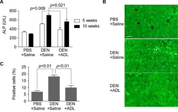 Reduction of DEN-induced hepatotoxicity by ADL oral gavage (A) Blood ALP activity. 50 mg/kg DEN or phosphate buffered saline (PBS) were treated through i.p. injection once a week, and 0.5 g/kg Allomyrina dichotoma Larva (ADL) powder or saline was administered 5 times a week via oral gavage to C3H/HeN male mice as indicated (n=10 for each group). Alkaline phosphatase (ALP) activity was measured in the mouse blood sample. The data are mean±SEM. (B) TUNEL staining of liver tissues. After treatment of DEN and ADL as in (A), liver issues were stained with TUNEL to show apoptotic cells. Scale bar, 25 μm. 200X magnification. Arrow heads indicate example TUNEL-positive cells. (C) Percentage of TUNEL positive cells per microscopic field. TUNEL positive cells were counted from 20 microscopic fields. The data are mean±SEM.