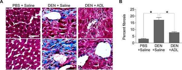 Protection of liver damage by PBL oral gavage (A) Masson’s Trichrome staining. The mouse liver sections were stained by the Masson’s trichrome protocol. Scale bar, 50 μm. 200X magnification. (B) Percent fibrosis analysis. Blue staining in (A) were counted from 10 microscopic fields. The data are the mean±SEM. *, p<0.001