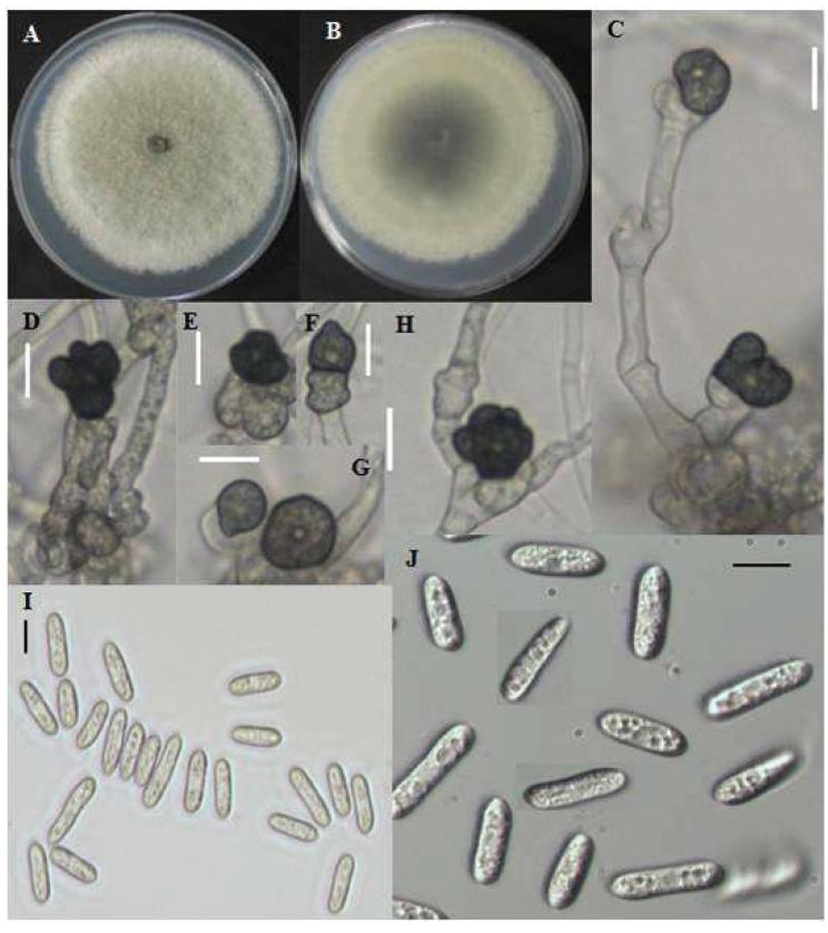 Colletotrichum fructicola CNU122031 의 형태적 특징.