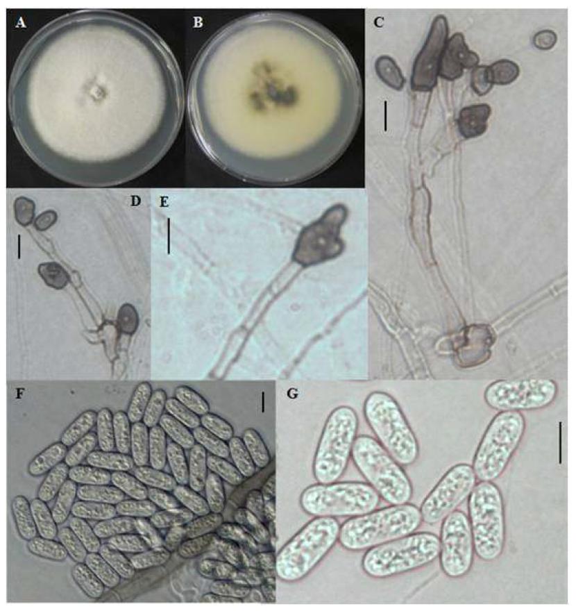 Colletotrichum brevisporum CNU122032 의 형태적 특징.