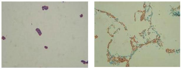 Bacillus GR4-5의 형태 및 내생포자