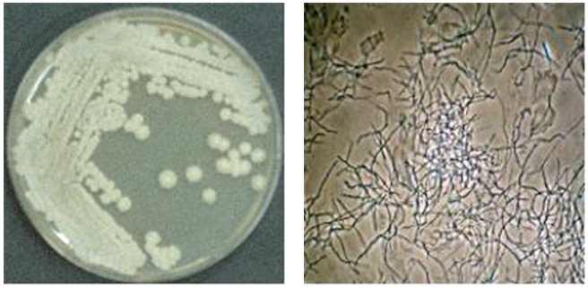 Streptomyces BK185 영양배지 상 생육
