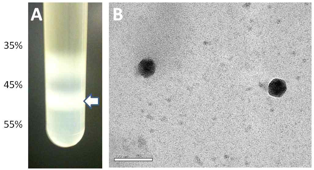 Sucrose gradient ultracentrifuge purification of SBV. A. A crude virus extract from A. cerana was subjected to a sucrose gradient of 35%~55% for ultracentirifugation. The virus band formed between 45% and 55% layer was collected after ultracentrifugation with Beckman SW40.1 rotor for 1 hr at 30,000rpm. B. SBV particles purified by ultracentrifugation was stained with 0.5% uranyl acetate and observed by transmission electron microscope. The sizebar indicates 100nm.