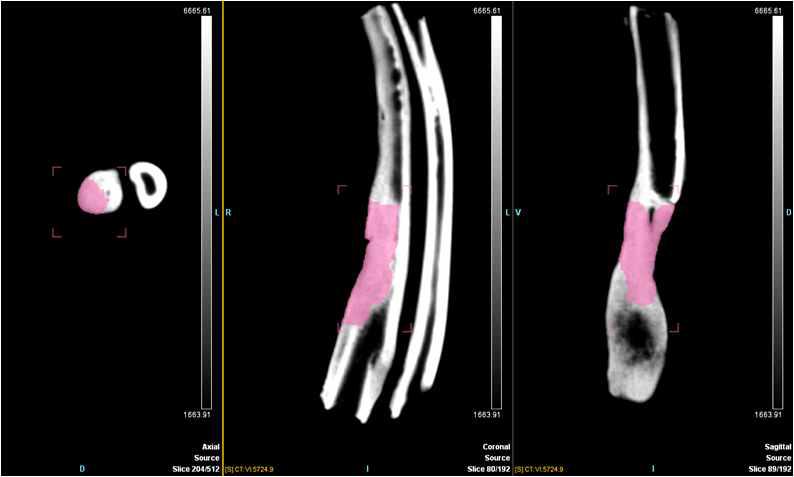 전완골 결손부 모형에서 골 재생 효과에 대한 micro-CT 분석