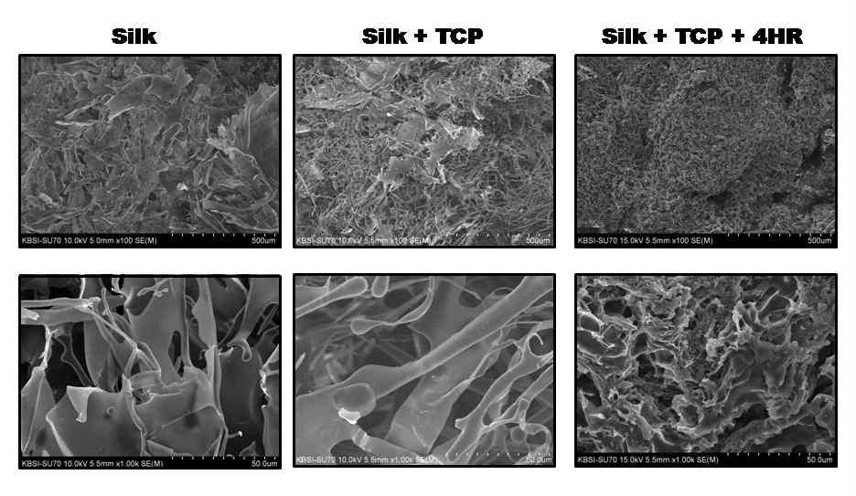 각각의 실크 복합 소재에 대한 주사전 자현미경 소견
