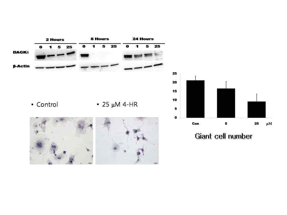 4-HR에 의한 DAGK-delta의 발현량 변화 및 거대세포 형성 억제