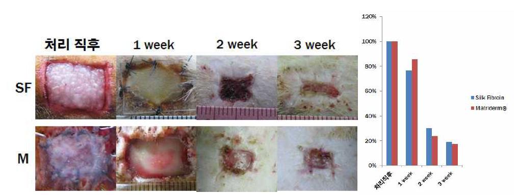 실크 피브로인 나노 섬유막과 MatridermⓇ 의 치유 면적 측정