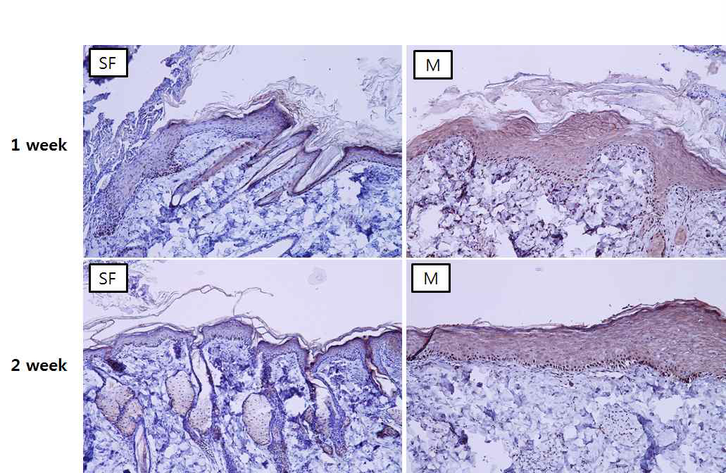 실크 피브로인 나노 섬유막과 MatridermⓇ 의 IHC(PCNA) 염색