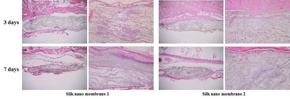 인공 진피용 실크 나노 섬유막의 생분해 관찰