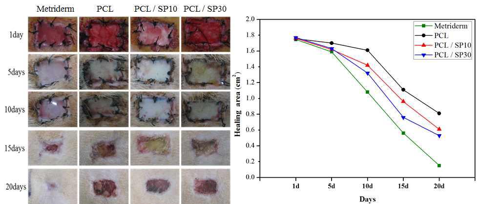 인공 진피용 3차원 나노 섬유지지체의 healing area 관찰 결과