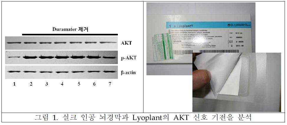 실크 인공 뇌경막과 Lyoplant의 AKT 신호 기전을 분석