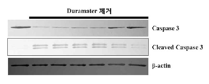 실크 인공 뇌경막과 Lyoplant의 세포 사멸 기전 분석