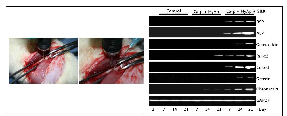 실크 인공뼈와 상용 인공뼈의 뼈 생성인자 비교 연구