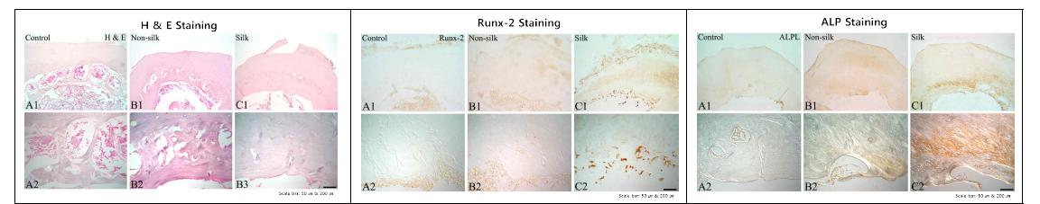 실크 인공뼈와 상용 인공뼈의 뼈 생성 비교