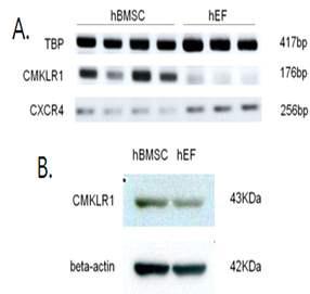 중간엽줄기세포와 섬유아세 포에서CMKLR1 mRNA 및 단백질 의 발현을 RT-PCR(A)과 웨스턴블롯 팅(B)으로 분석하였음.