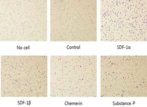 Transwell migration assay.