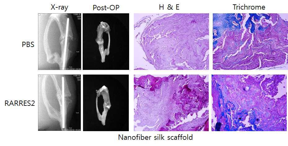 Nanofiber 실크지지체(+/_ RARRES2)의 골형성능을 경골 골수강정 모델로 분석함.
