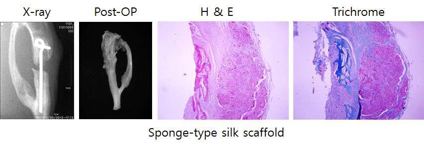 해면상 실크지지체의 골형성능을 경골 골수강정 모델로 분석.