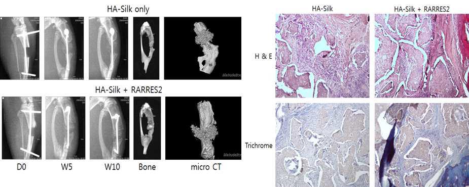 (좌) 경골 골수강정 모델에서 RARRES2를 흡수시킨 HA 실크지지체의 골형성 효과를 X-ray, micro CT로 분석. (우) 경골 골수강정 모델에서 RARRES2를 흡수시킨 HA 실크지지체 에서의 골형성도를 H & E 및 Trichrome 조직염색으로 관찰함.